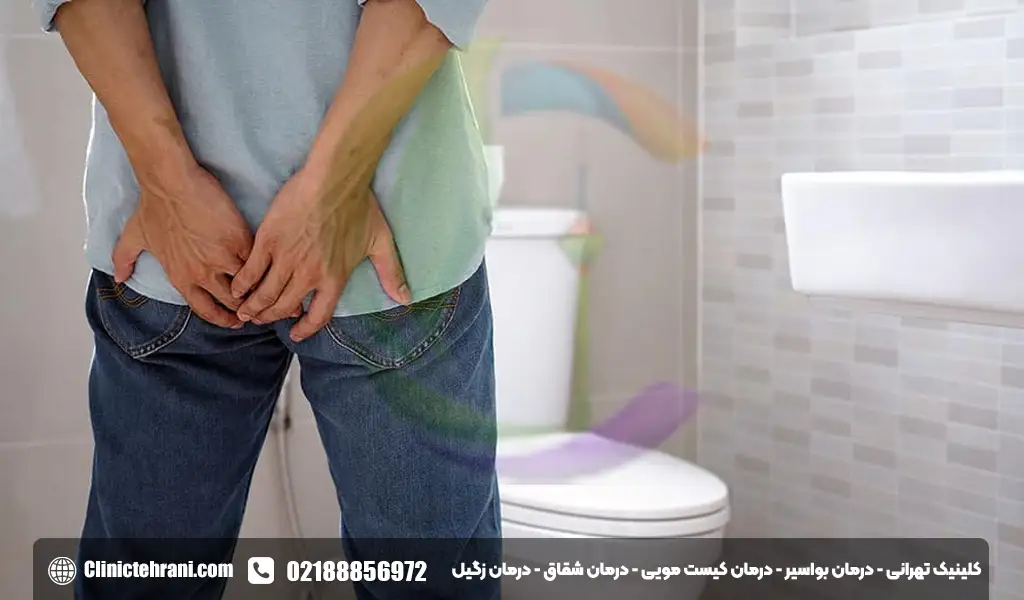 علائم شقاق مقعدی