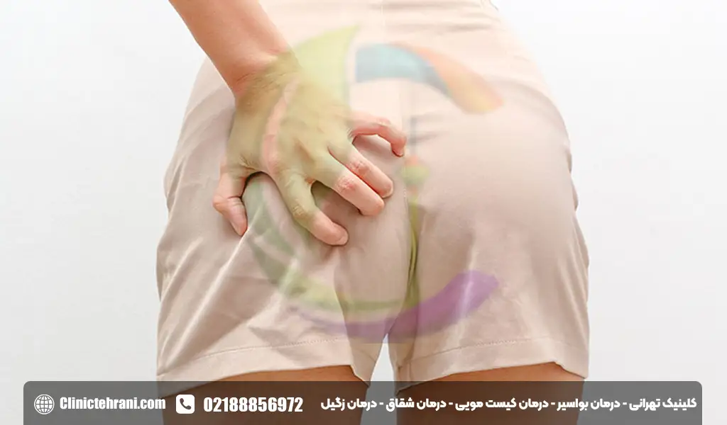 خارش مقعد