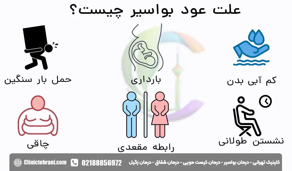 علت عود بواسیر چیست؟
