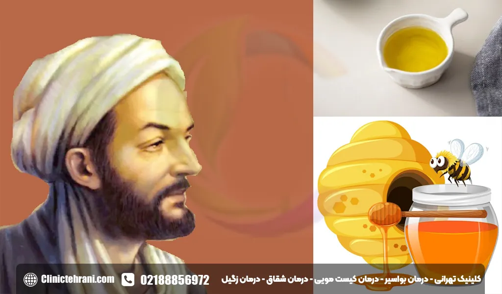 درمان شقاق مقعدی در طب سنتی