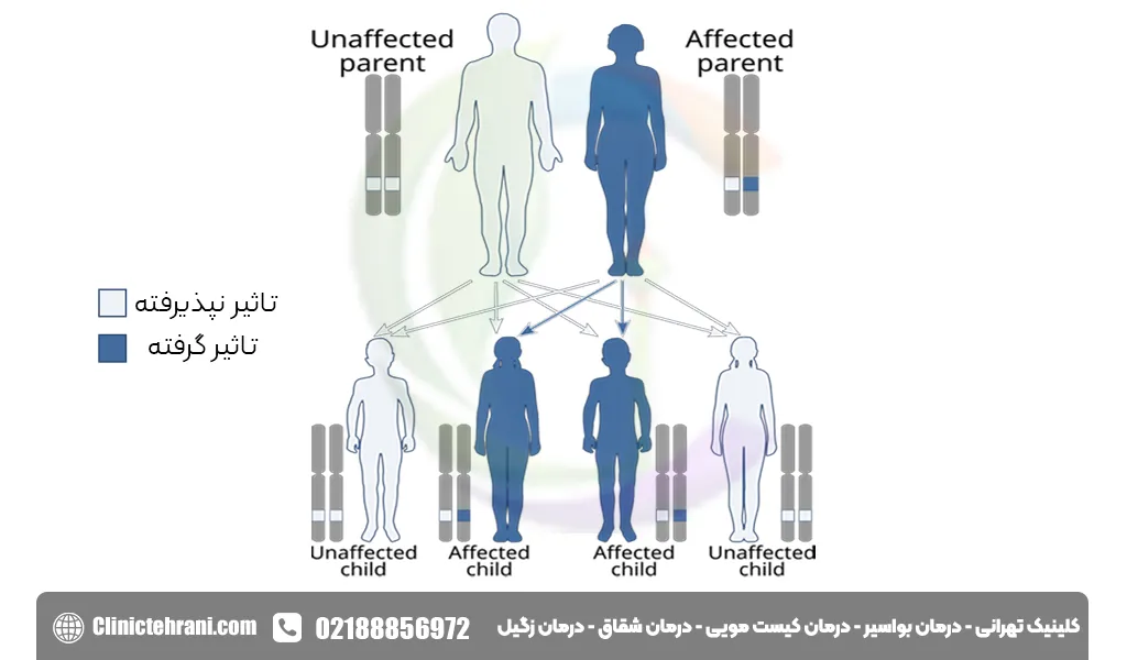 دلایل به وجود آمدن زگیل تناسلی