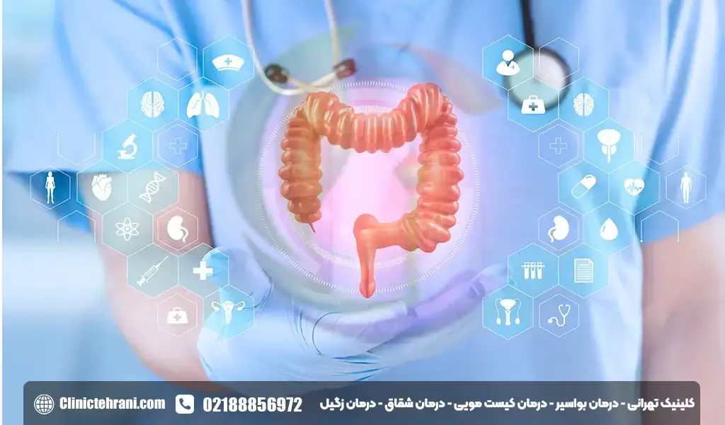 راست روده چیست