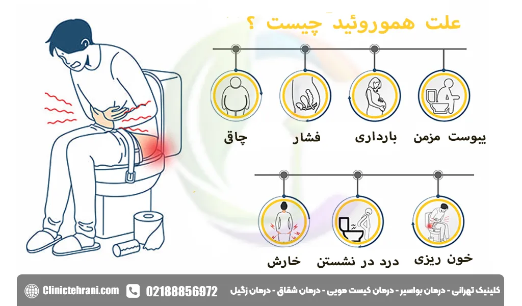 درمان جوش مقعدی با عسل