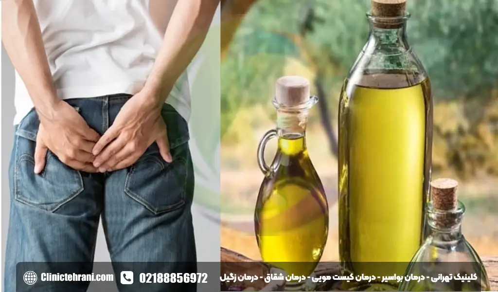 روغن زیتون برای درمان بواسیر