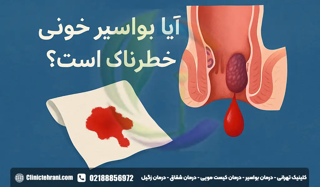ایا بواسیر خونی خطرناک است؟