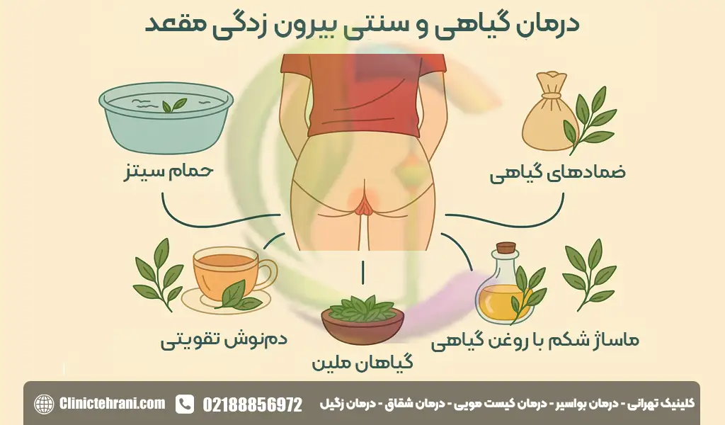 درمان گیاهی و سنتی بیرون زدگی مقعد