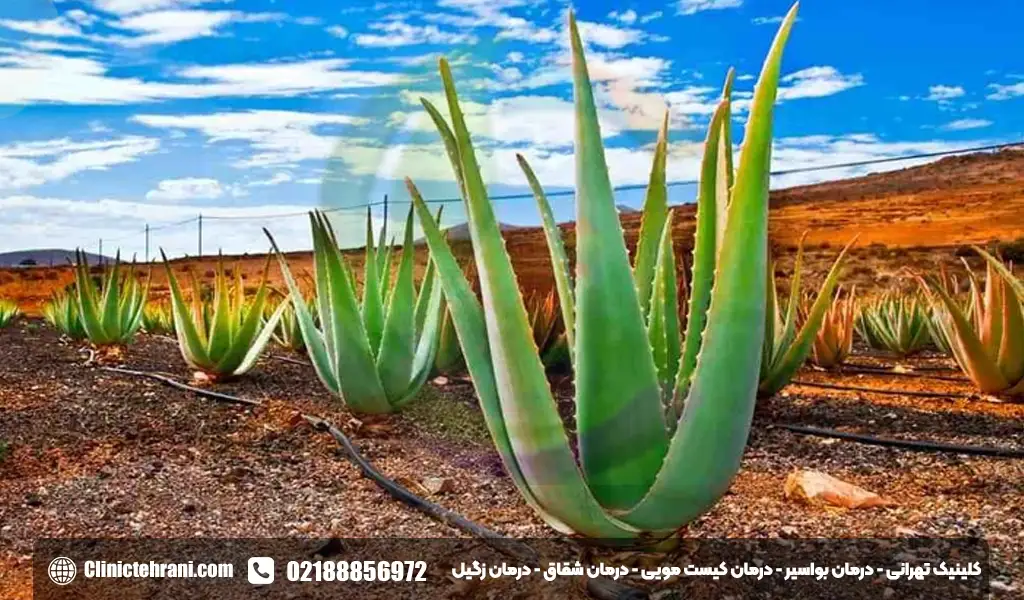 آلوئه ورا برای کیست مویی