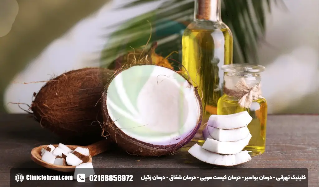 روغن نارگیل برای کیست مویی