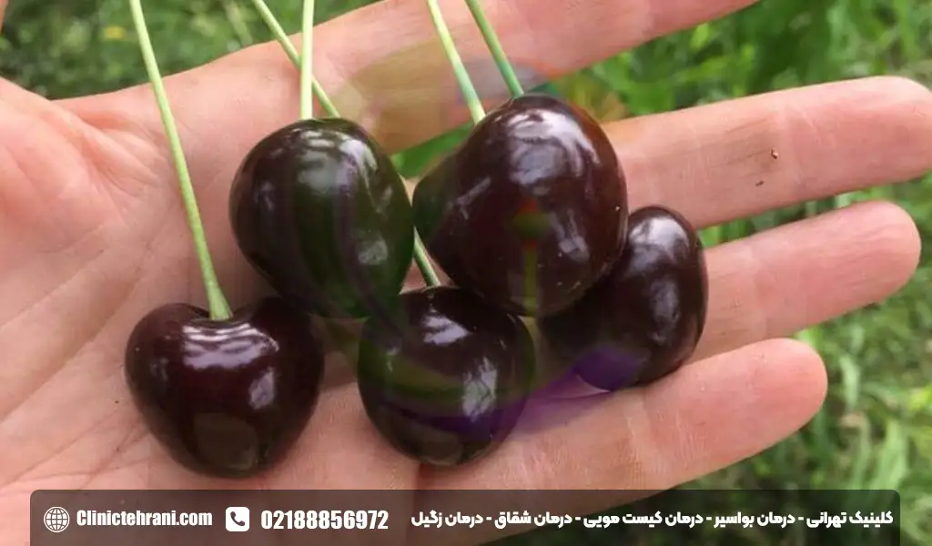 گیلاس برای بواسیر