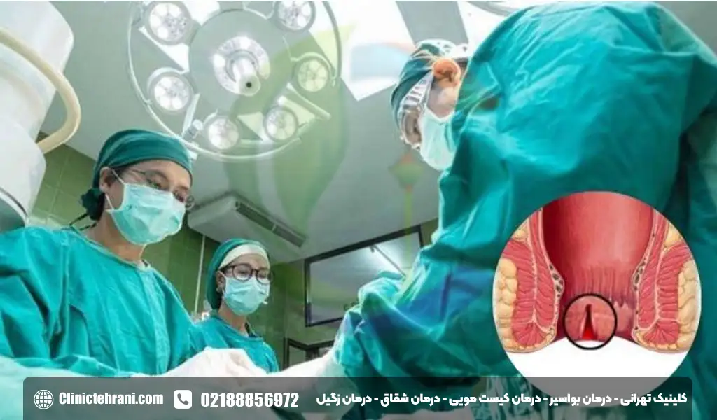 عمل شقاق مقعدی