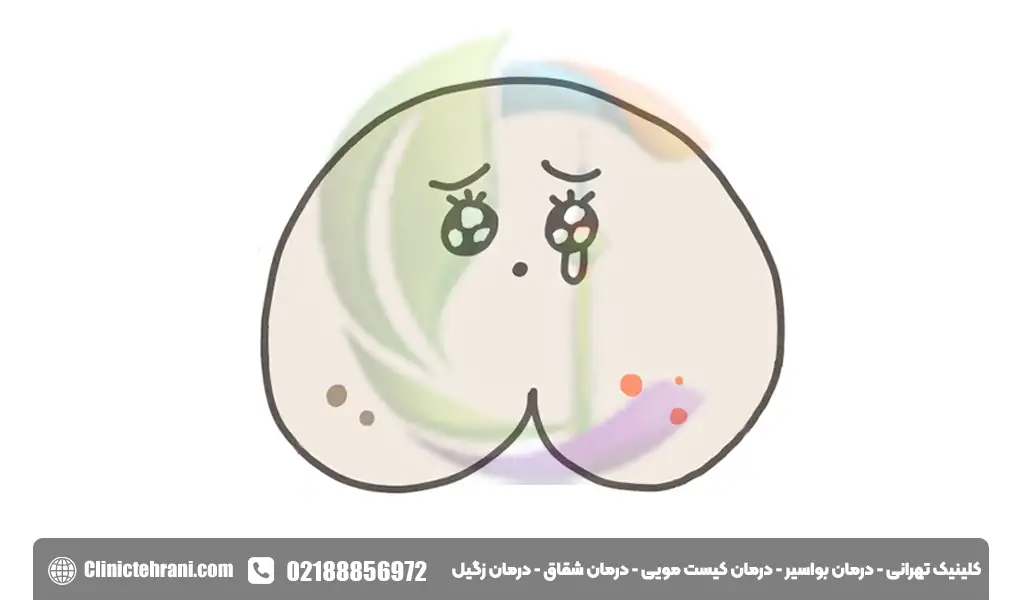 ترشحات بعد از لیزر آبسه مقعدی