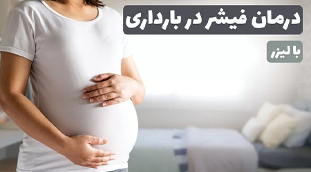 درمان فیشر در بارداری