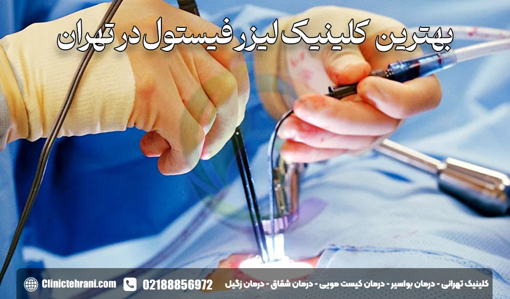 بهترین کلینیک لیزر فیستول در تهران