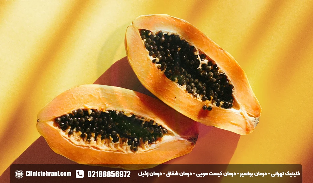 درمان فیستول مقعد