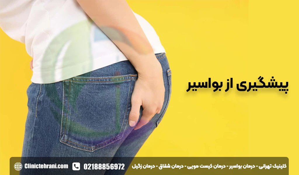 پیشگیری از بواسیر