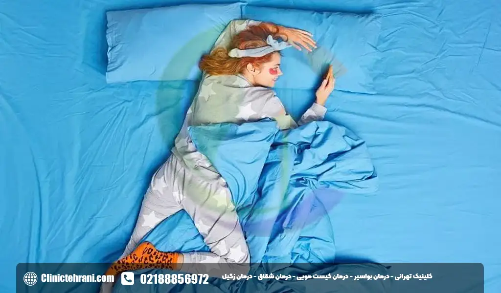 نحوه خوابیدن بعد از عمل کیست مویی