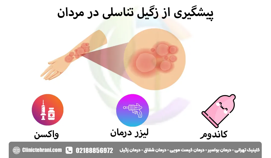  پیشگیری از زگیل تناسلی در مردان