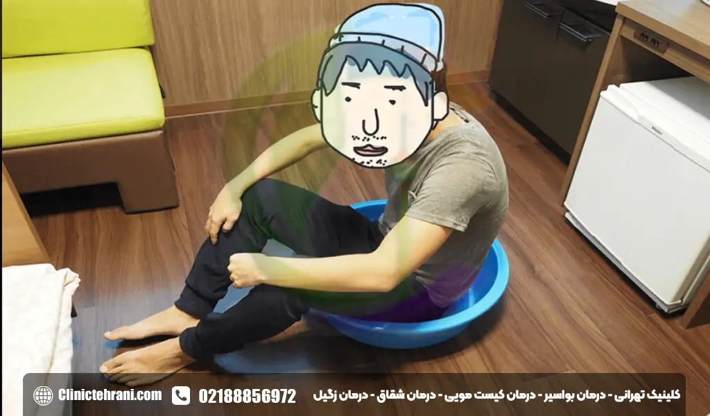 حمام سیتز برای شقاق