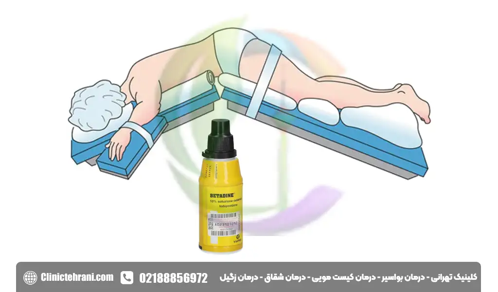نحوه استفاده از بتادین برای شقاق مقعدی
