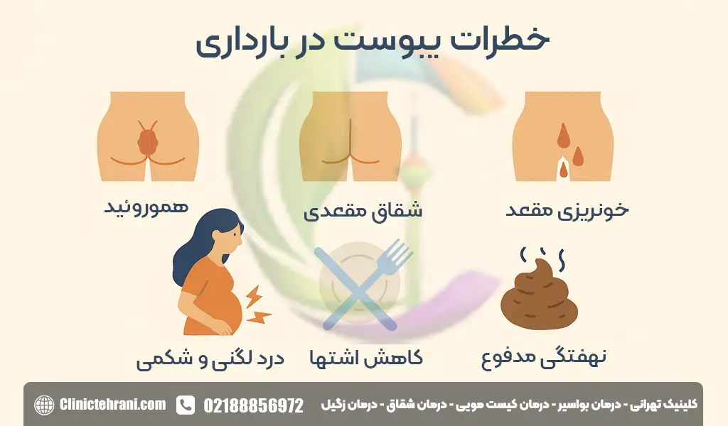 درمان یبوست خیلی شدید در بارداری