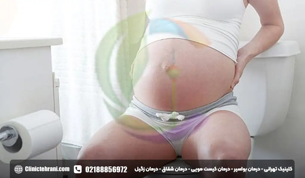 یبوست در بارداری