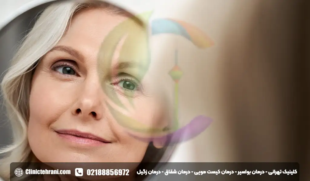 ویتامین ای برای صورت