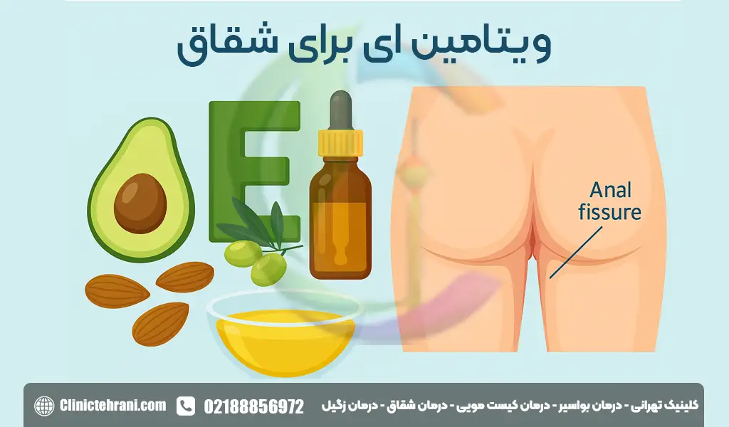 ویتامین ای برای شقاق