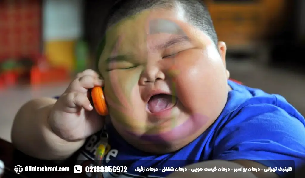 ویتامین ای برای چاقی صورت