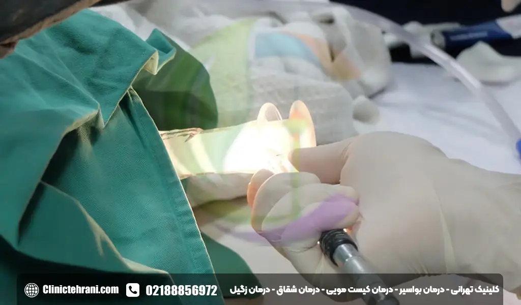 معاینه مقعدی چگونه است؟