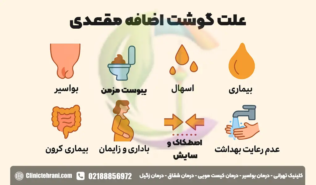علت گوشت اضافه مقعدی