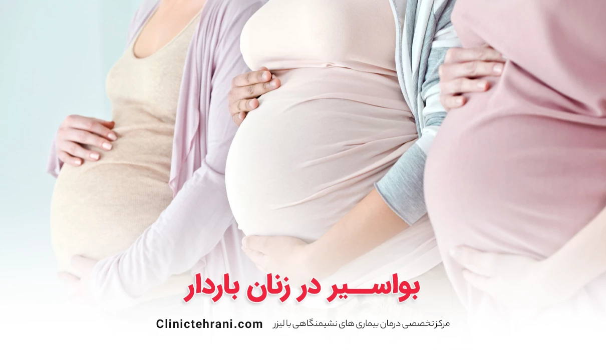 بواسیر در زنان باردار