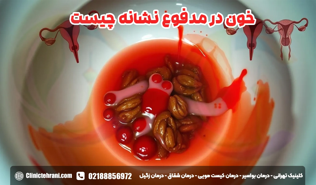 خون در مدفوع نشانه چیست
