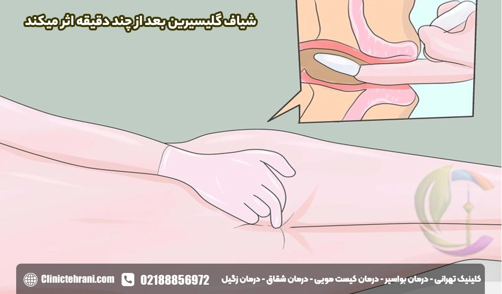 شیاف گلیسیرین بعد از چند دقیقه اثر میکند