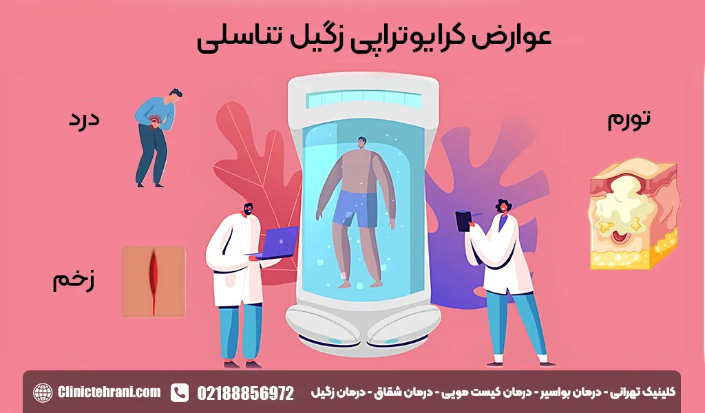 عوارض کرایوتراپی زگیل تناسلی