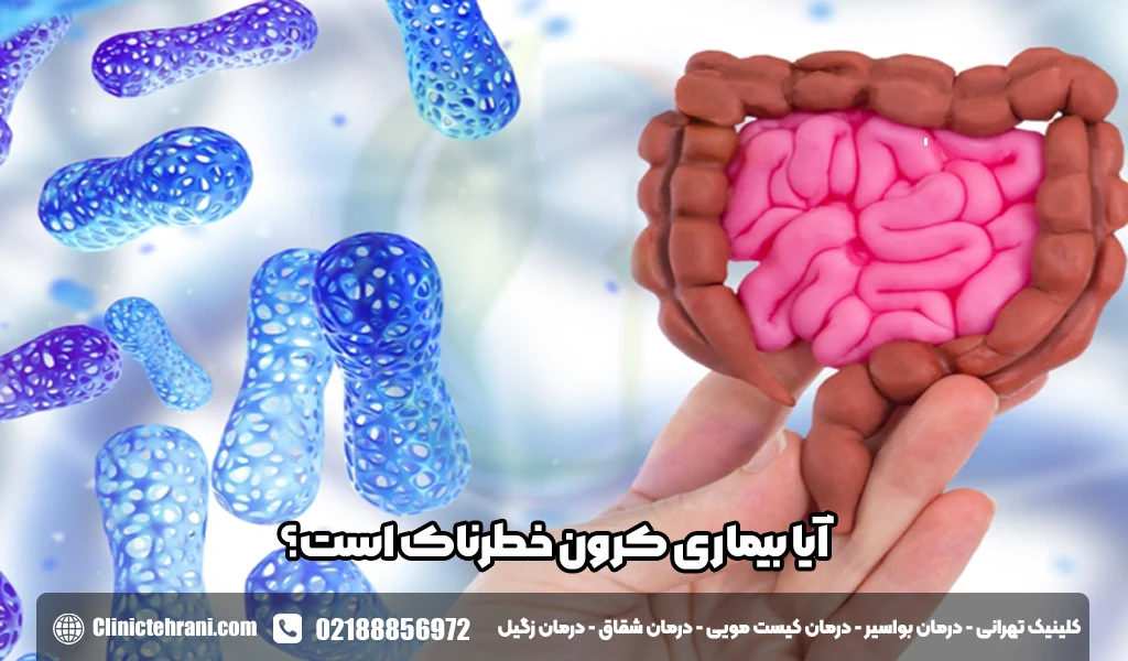 آیا بیماری کرون خطرناک است؟