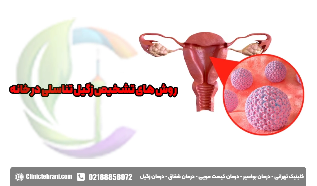 روش‌های تشخیص زگیل تناسلی در خانه