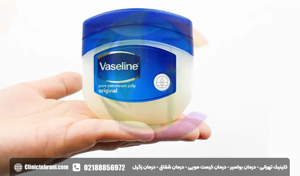 وازلین برای درمان بواسیر