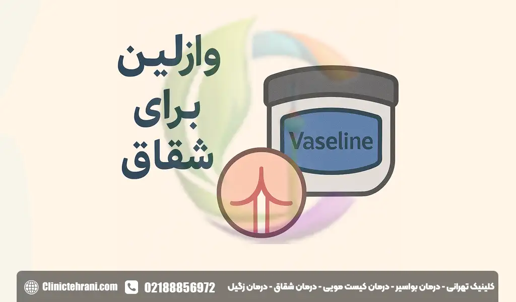 وازلین برای شقاق