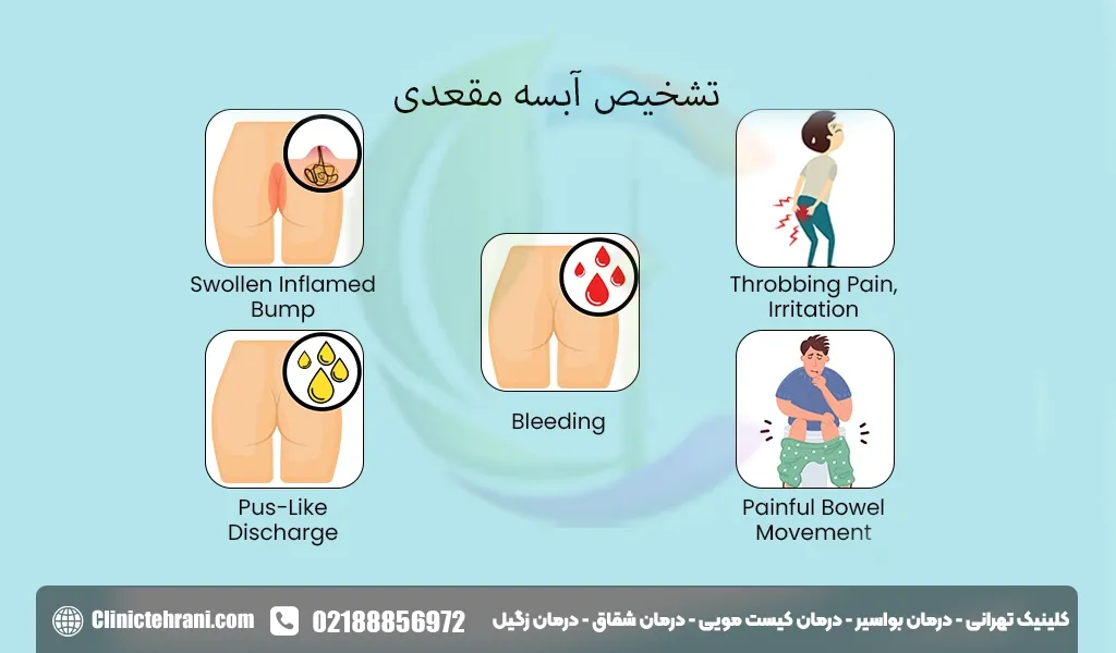 تشخیص آبسه مقعدی