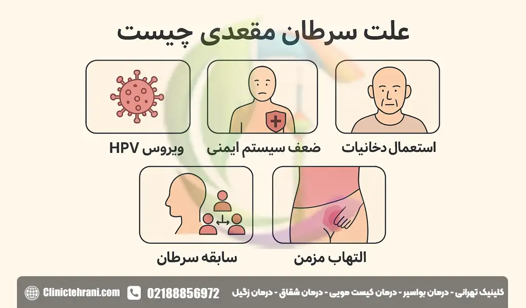 علت سرطان مقعدی چیست