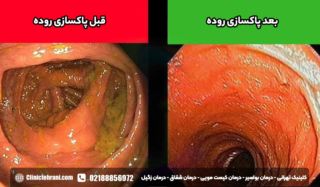 برای پاکسازی معده و روده چه بخوریم