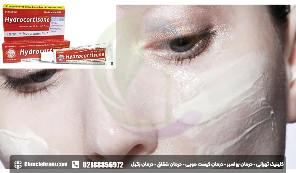پماد هیدروکورتیزون برای لک صورت