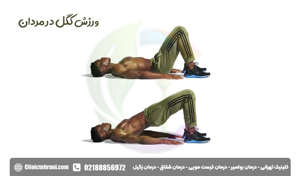 ورزش کگل برای مردان