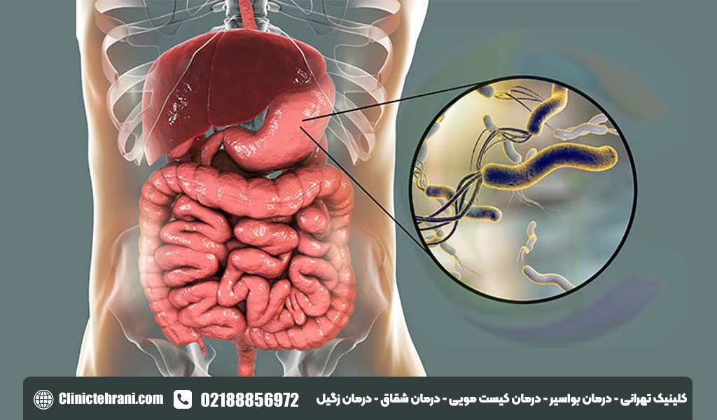 چه غذاهایی برای میکروب معده خوب است