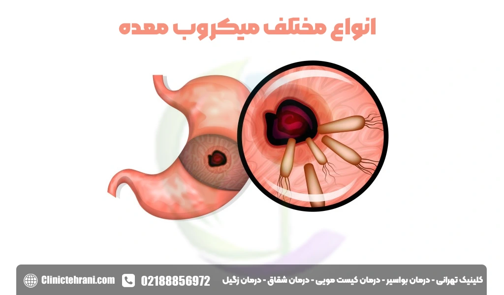 انواع مختلف میکروب معده