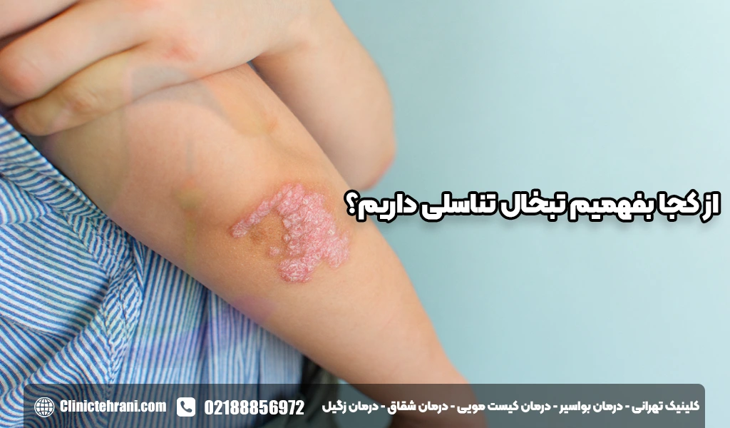 از کجا بفهمیم تبخال تناسلی داریم؟