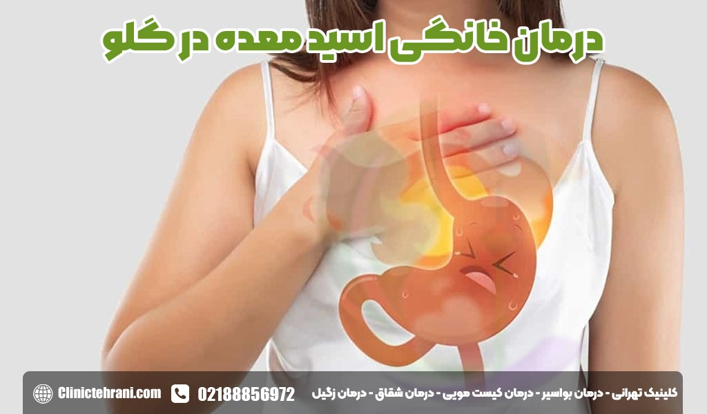 درمان خانگی اسید معده در گلو