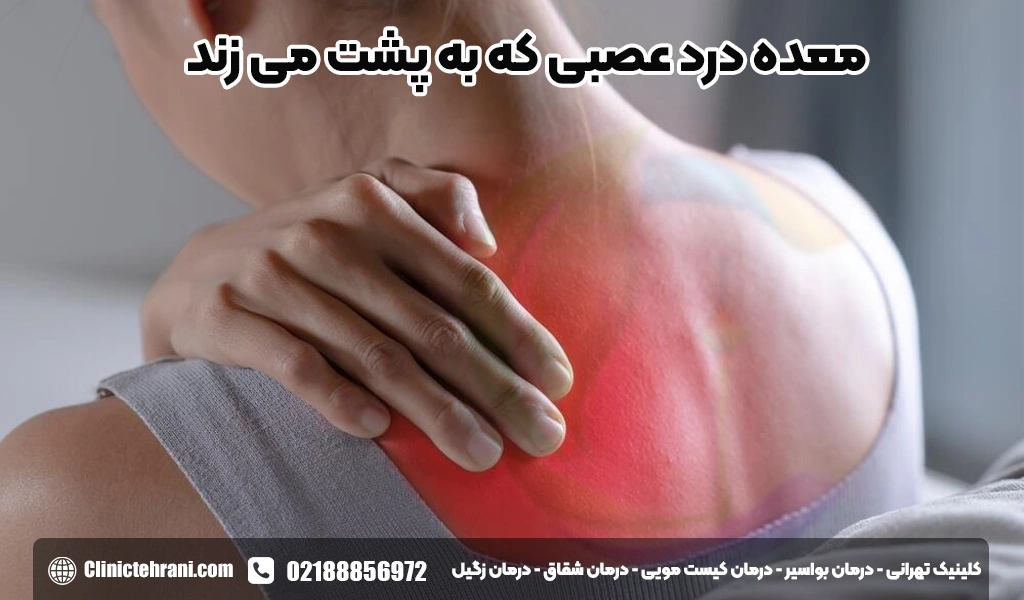 معده درد عصبی که به پشت میزند