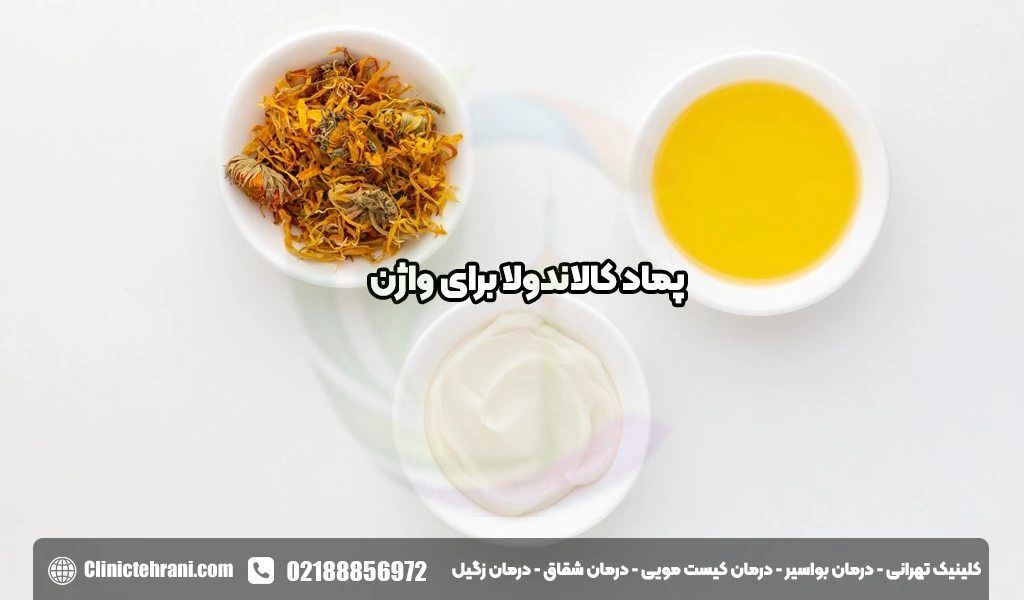 پماد کالاندولا برای واژن