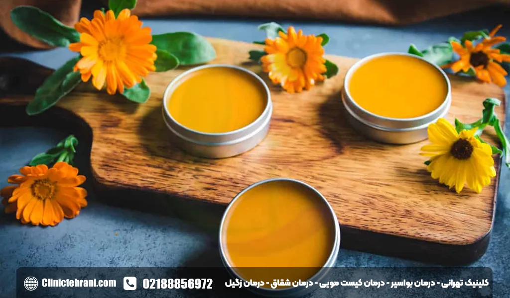 پماد کالاندولا